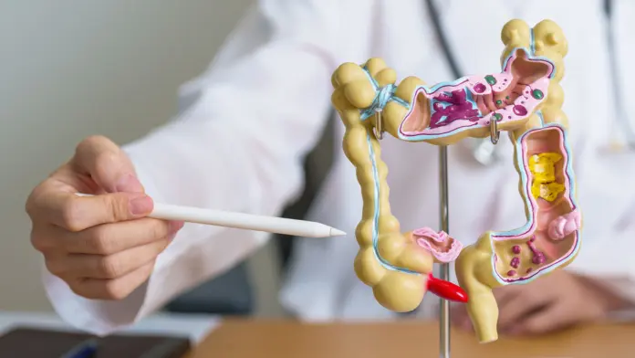 Alimentos que reducen riesgo de cáncer de colon